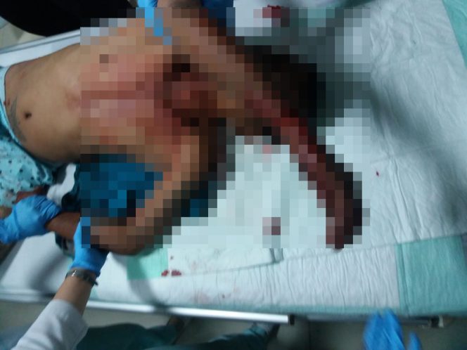 
					Supir Angkot D-112 Dikeroyok Preman Hingga Kritis