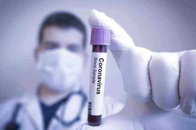 
					Tamansari Zona Merah, Terkonfirmasi Positif Terus Bertambah