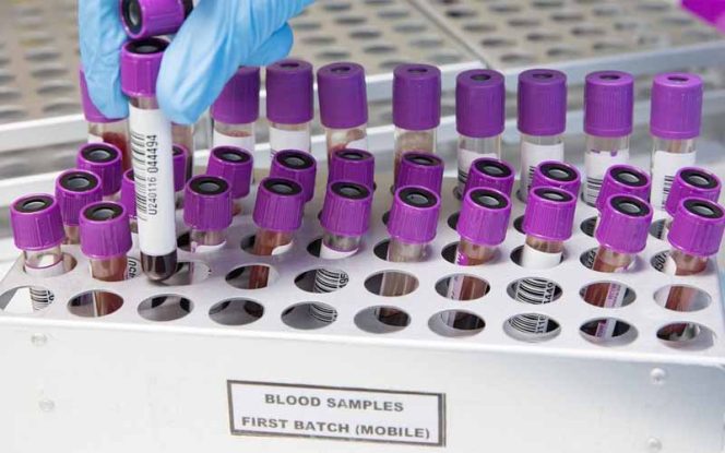 
					Plasma Darah Dikembangkan Untuk Penyembuhan COVID-19